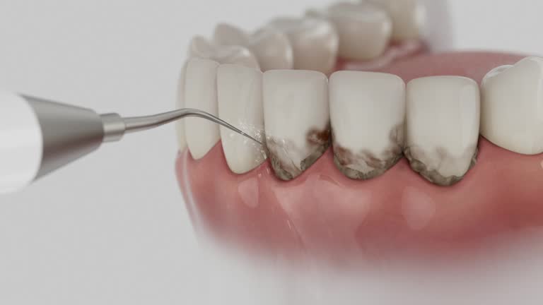 Trusted Teeth Cleaning And Checkup service in South Lakes, AK - Dentist Open Now